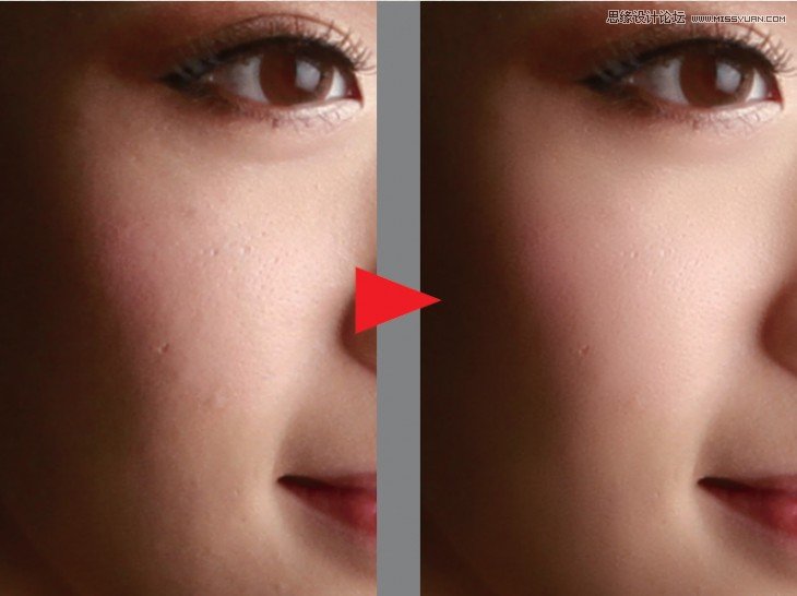 用PS快速的给人像皮肤后期智能美肤